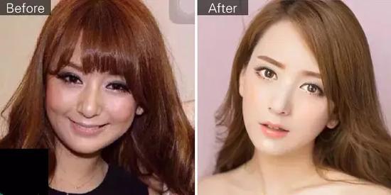 罗志祥网红女友周扬青整容前后对比图——